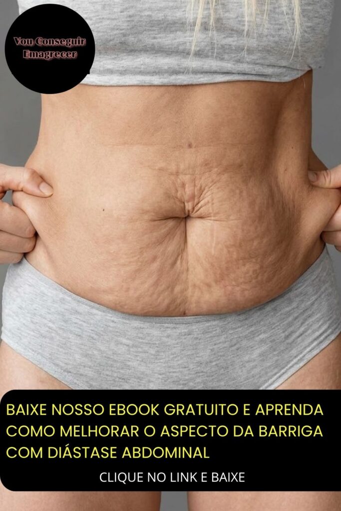 Diastase abdominal pós parto